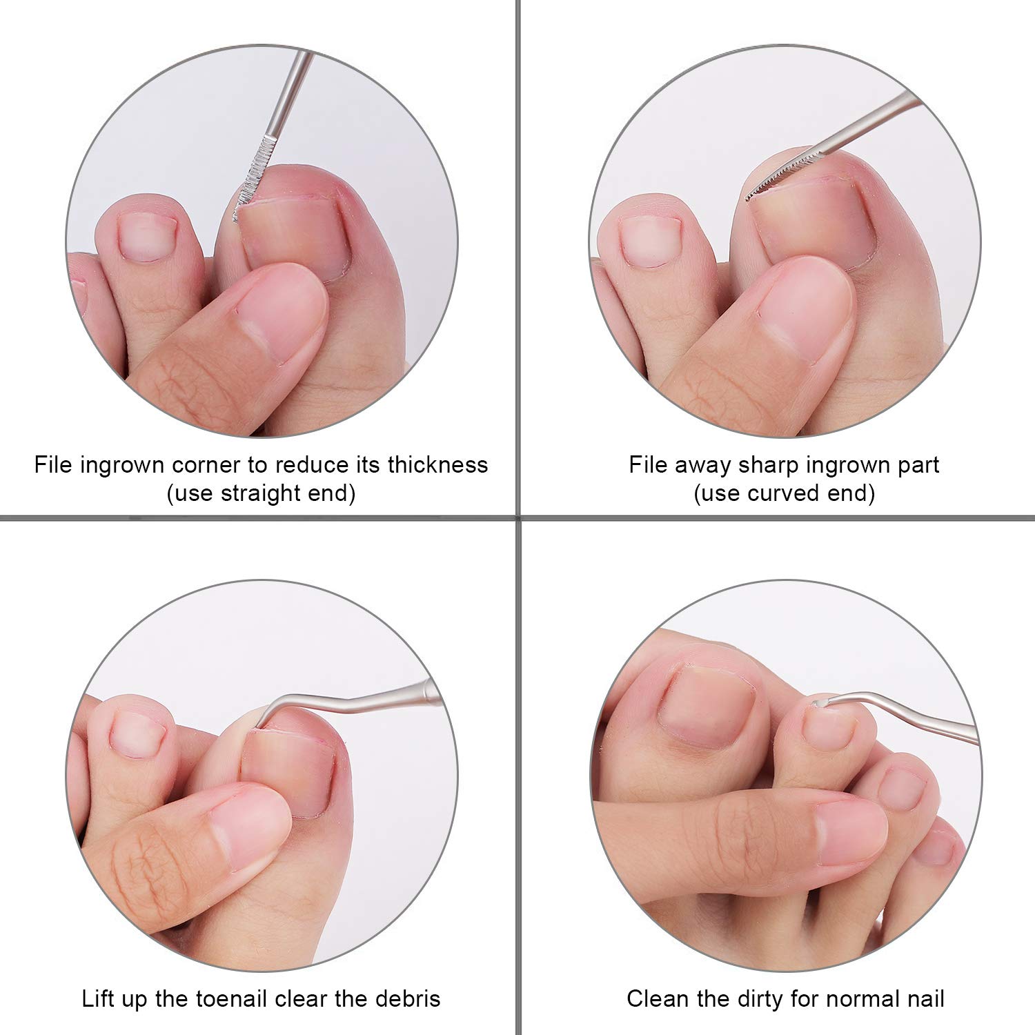 YINYIN Ingrown Toenail File & Lifter Set | Professional Stainless Steel Cleaner (15cm) | Get Relief Fast - Image 6